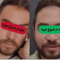 چاقی کاملا گیاهی و ارگانیک صورت