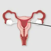 پاکسازی کامل بدن