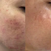 فیشال تخصصی اقایان و بانوان کلینیک پزشک(اف۵۰تخفیف)|خدمات آرایشگری و زیبایی|بیرجند, |دیوار