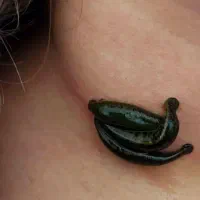 طب سوزنی،حجامت،زالو درمانی،تشخیص بیماری|خدمات آرایشگری و زیبایی|کرج, خرمدشت|دیوار