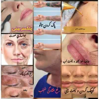خال برداری،رفع چین و چروک،جوان سازی با لیزر