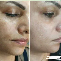 توی ۳ روز سفید برفی و بلوری شو|خدمات آرایشگری و زیبایی|امیدیه, |دیوار