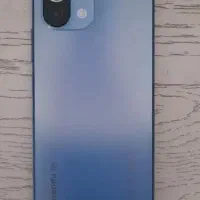 گوشی mi11 لایت