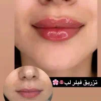 جشنواره تابستانه تزریق فیلروبوتاکس درکلینیک زیبایی|خدمات آرایشگری و زیبایی|اصفهان, وحید|دیوار