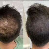 مدل دستمزد رایگان اسکالپ مو خانم ها توسط استاد|خدمات زیبایی و سلامت|تهران, میرداماد|دیوار