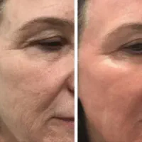 کرم جوانساز بیوممتیک لاکچری کویین