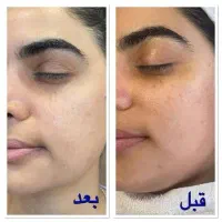 فیشیال ویژه بانوان عزیز و آقایون|خدمات آرایشگری و زیبایی|کرمانشاه, |دیوار