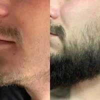 کمکت میکنم از کوسه بودن خلاص شی