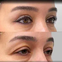 پوست مو . ژل . لیزر . بوتاکس مطب داخلی رامینا