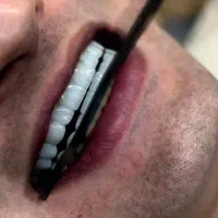 دندانسازی پیشداد