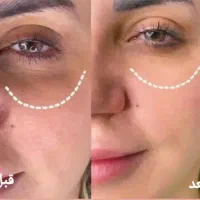 جشنواره پاکسازی پوست آقایون و خانوم ها فقط580