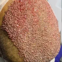 کاشت مو اقساطی بدون سود|خدمات آرایشگری و زیبایی|مشهد, هنرستان|دیوار