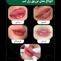 نیازمند مدل ژل نخ فیلر و بوتاکس فقط هزینه مواد