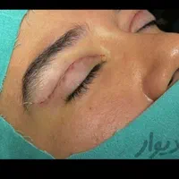 لیپوساکشن ،پیکرتراشی، جراحی زیبایی ،ابدومینوپلاستی|خدمات آرایشگری و زیبایی|تهران, شهرآرا|دیوار