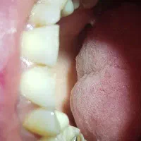 دستیار دندانپزشک