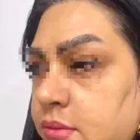 جشنواره لاغری 3تا12سانت در1جلسه وهایفوتراپی vip|خدمات آرایشگری و زیبایی|رشت, پارک شهر|دیوار