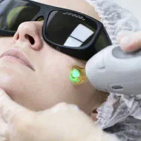 لیزر موهای زائدبا دستگاه شاتی کندلا2026