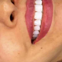 خدمات دندانپزشکی طرح همایتی(نیمه رایگان)