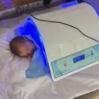 دستگاه زردی نوزاد در فردیس و ملارد (تست زردی دقیق)|خدمات آرایشگری و زیبایی|فردیس, فردیس|دیوار