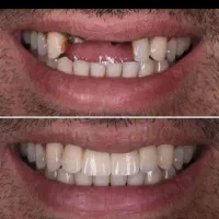 کلیه خدمات دندانپزشکی مناسب همه|خدمات آرایشگری و زیبایی|کرمانشاه, |دیوار