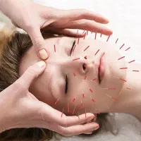 طب سوزنی تخصصی «اکوپانچریست»امبدینگ لاغری|خدمات زیبایی و سلامت|تهران, دبستان|دیوار