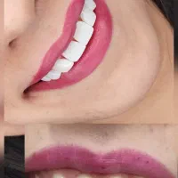 تا ۱۵٪ تخفیف ویژه دندان پزشکی (مدت محدود)