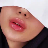 مدل فیلر لب و بوتاکس و خط خنده