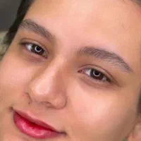 میکروبلیدینگ و فیبروز  صورت بدون درد و خونریزی