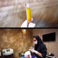 پی ار پی و مزوتراپی در اصفهان (کلینیک آفتاب)