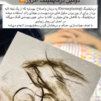 اصلاح درماپلنینگ