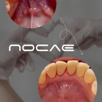 دندان مصنوعی و کامپوزیت|خدمات آرایشگری و زیبایی|سروآباد, |دیوار