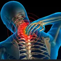 دیسک گردن و عصب سیاتیک