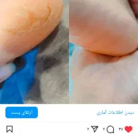 پدیکور تخصصی درمانی و زیبایی