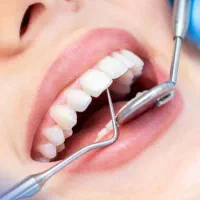 کشیدن دندان بدون درد و خونریزی باضمانت