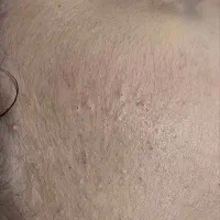 فیشیال و پاکسازی تخصصی پوست با کلی تخفیف|خدمات آرایشگری و زیبایی|خرمشهر, |دیوار