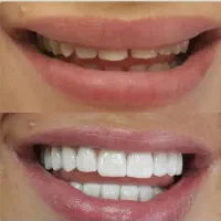 دندانپزشکی/تحویل سریع/جشنواره تخفیفات