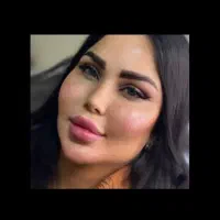 ژل/بوتاکس/چربی/مزوژل/وآموزش گروهی وخصوصی|خدمات آرایشگری و زیبایی|اهواز, گلستان|دیوار