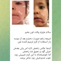 پوستت هلوی با تکسو|خدمات آرایشگری و زیبایی|کرمان, |دیوار