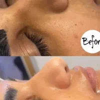 فیشال تخصصی پوست|خدمات آرایشگری و زیبایی|پرند, فاز ۵|دیوار