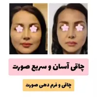 چاقی ۱۰۰ درصدی صورت و بدن|آرایشی، بهداشتی، درمانی|تهران, چیتگر جنوبی|دیوار