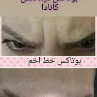 آموزش و خدمات ژل و بوتاکس|خدمات آرایشگری و زیبایی|زابل, |دیوار