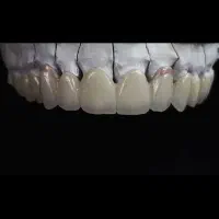 نیازمند کاراموز دندانسازی بخش قالبریزی (فقط خانم)