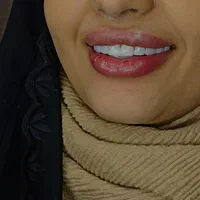 کلینیک تخصصی دندانپزشکی زیبایی و ایمپلنت|خدمات آرایشگری و زیبایی|تهران, هفت حوض|دیوار