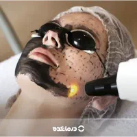 لیزر مو.کربن تراپی.ریمو تتو.روشن سازی.لیزرکیوسوییچ