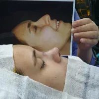 جراحی زیبایی بینی و پلک با تکنیک بدون تامپون