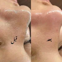 اپیلاسیون و اموزش با مدرک فنی حرفه ای|خدمات آرایشگری و زیبایی|مشهد, گلشور|دیوار