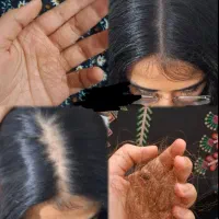 اکسیر جوانی و رشد مو و مژه