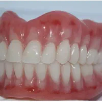 دندان مصنوعی