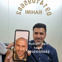 کاشت مو|خدمات آرایشگری و زیبایی|میانه, |دیوار