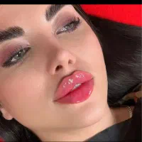 ۳۰٪تخفیف ژل بوتاکس نخ لیفت غبغب هایفو لیزر در مطب